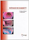 Capa do livro Esofago de Barrett, Artur Parada